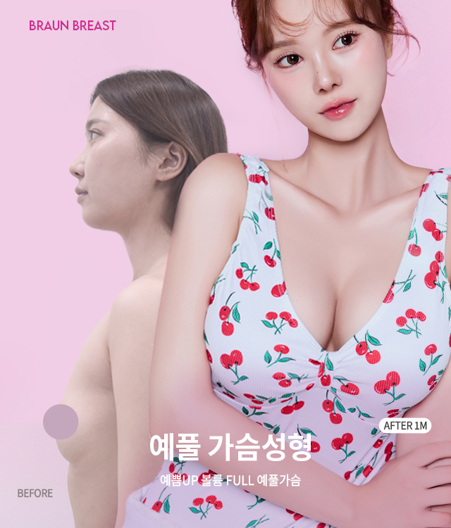 가슴확대