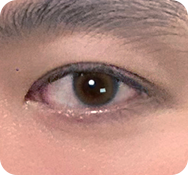 자연스러운 트임