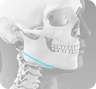 사각턱 동시 교정