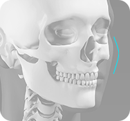 돌출각을 살린 광대