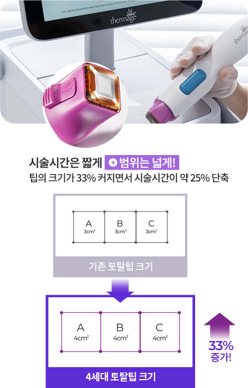 빨라진 시술 시간